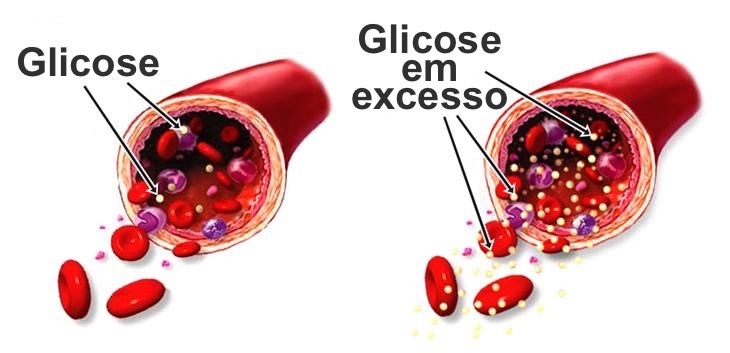 Glicose em Excesso